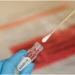 test covid coronavirus sursa dsp hunedoara