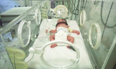 copiii prematuri prezintă un risc mai mare de multimorbiditate în